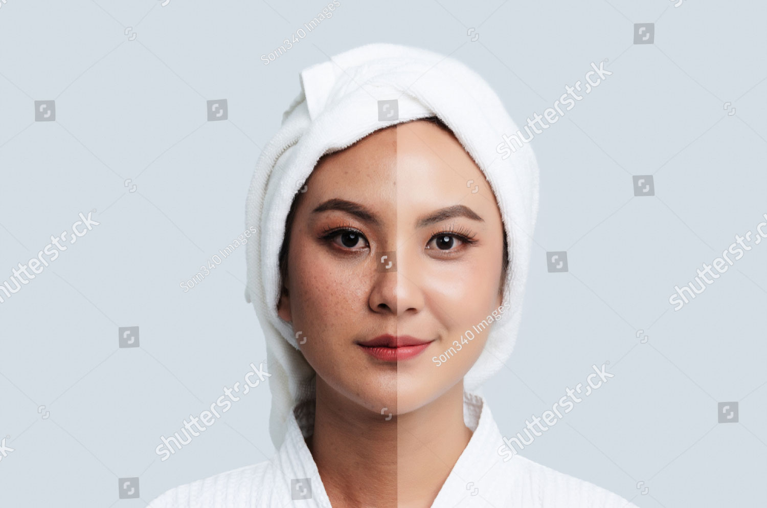 Comparison Portrait Of Beautiful Asian Woman Dark Spots And New Skin Before After Skin Care And 1389609878 